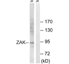 Western Blot - Anti-ZAK Antibody (B8200) - Antibodies.com