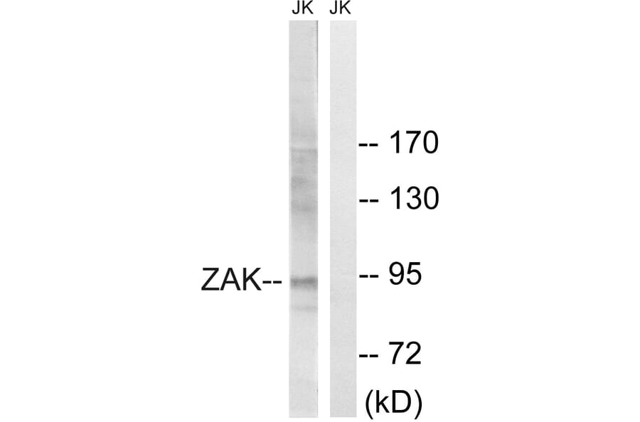 Western Blot - Anti-ZAK Antibody (B8200) - Antibodies.com