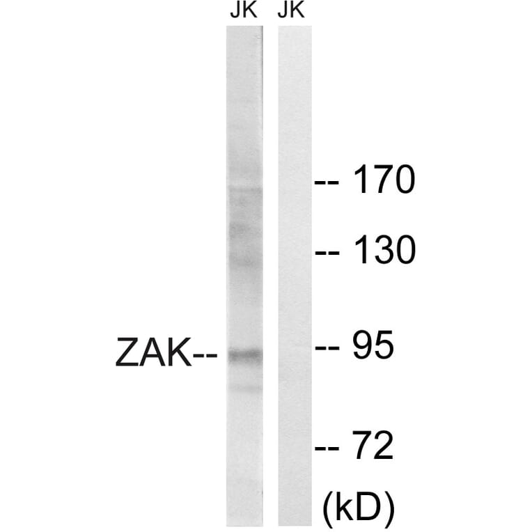 Western Blot - Anti-ZAK Antibody (B8200) - Antibodies.com