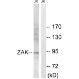 Western Blot - Anti-ZAK Antibody (B8200) - Antibodies.com