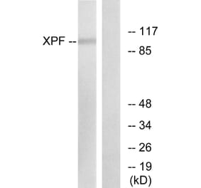 Western Blot - Anti-XPF Antibody (C0394) - Antibodies.com