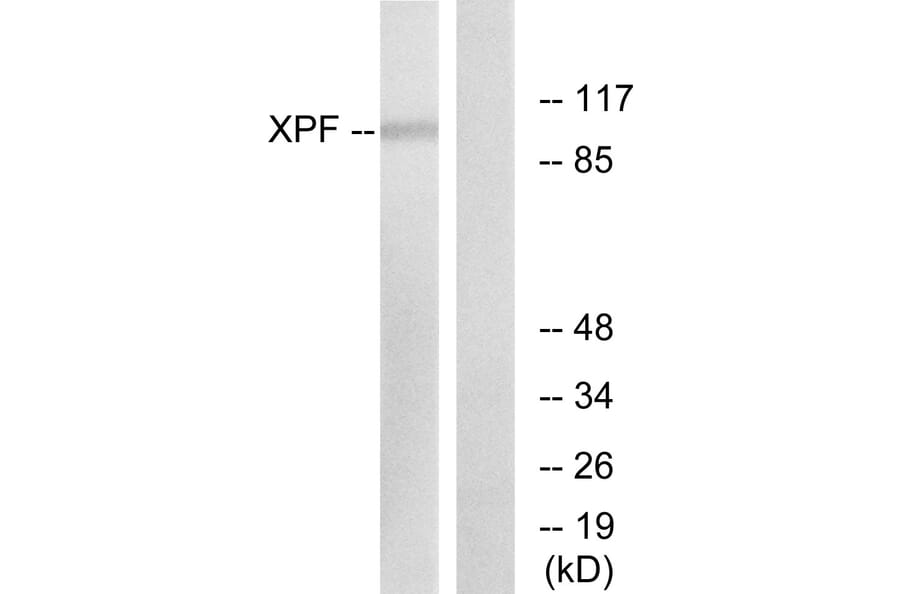 Western Blot - Anti-XPF Antibody (C0394) - Antibodies.com