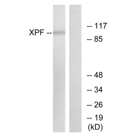 Western Blot - Anti-XPF Antibody (C0394) - Antibodies.com
