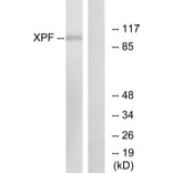 Western Blot - Anti-XPF Antibody (C0394) - Antibodies.com