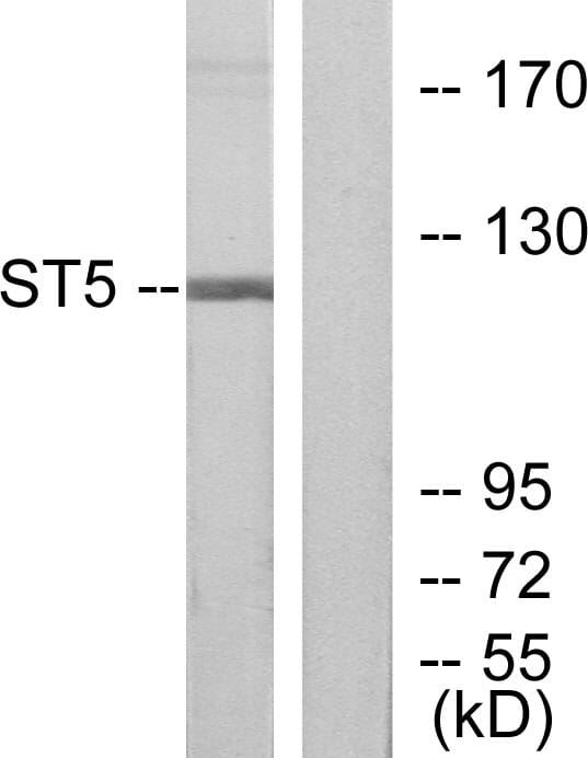 Western blot analysis of lysates from COLO205 cells using Anti-ST5 Antibody. The right hand lane represents a negative control, where the antibody is blocked by the immunising peptide.