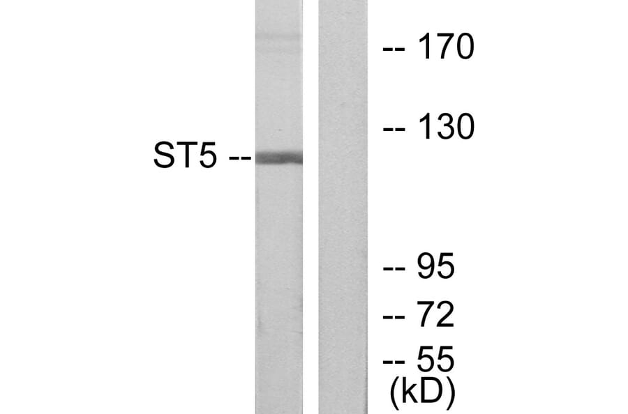 Western Blot - Anti-ST5 Antibody (C10797) - Antibodies.com