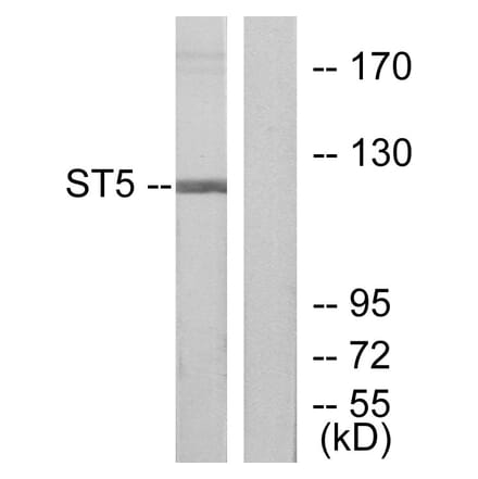 Western Blot - Anti-ST5 Antibody (C10797) - Antibodies.com