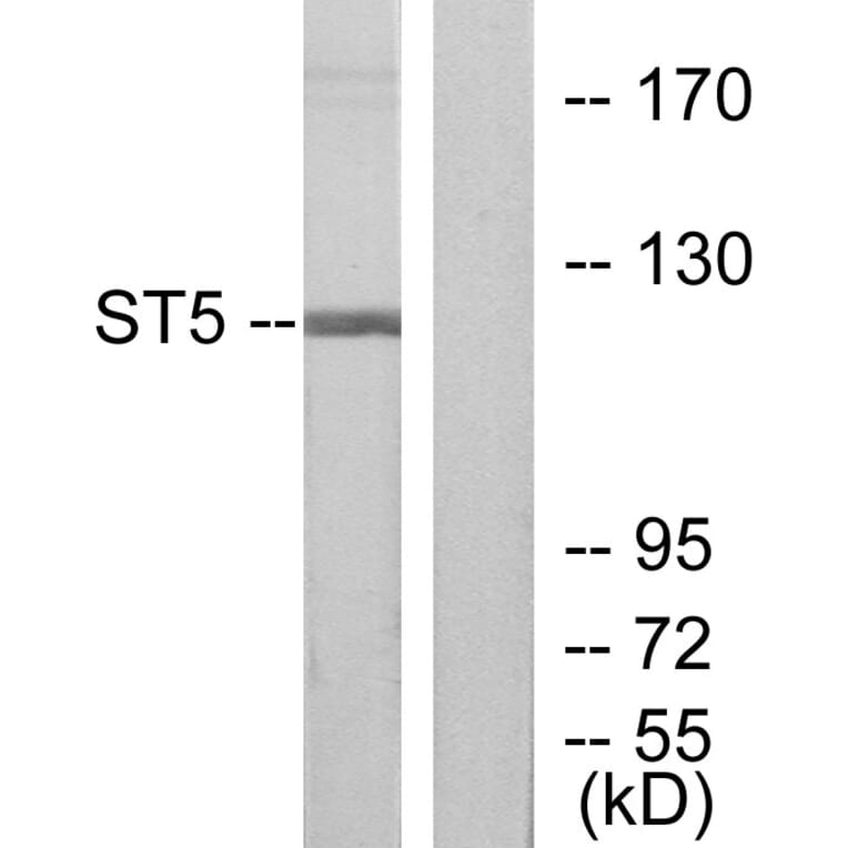 Western Blot - Anti-ST5 Antibody (C10797) - Antibodies.com