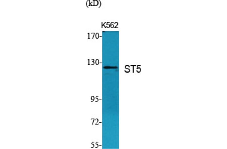 Western Blot - Anti-ST5 Antibody (C10797) - Antibodies.com