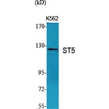 Western Blot - Anti-ST5 Antibody (C10797) - Antibodies.com