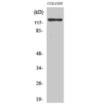 Western Blot - Anti-ST5 Antibody (C10797) - Antibodies.com