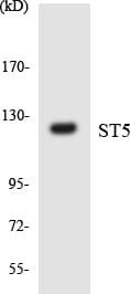 Western blot analysis of the lysates from COLO205 cells using Anti-ST5 Antibody.