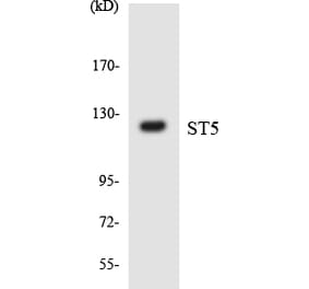 Western Blot - Anti-ST5 Antibody (R12-3566) - Antibodies.com