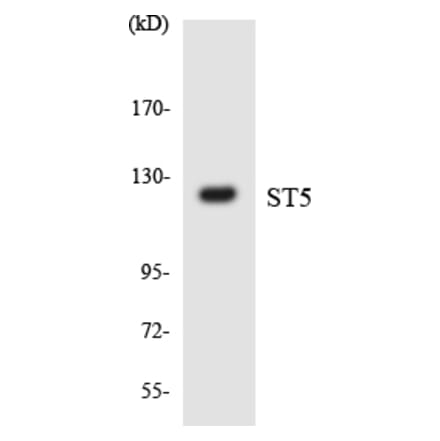 Western Blot - Anti-ST5 Antibody (R12-3566) - Antibodies.com