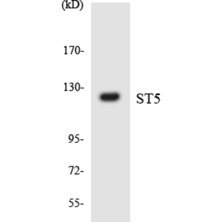 Western Blot - Anti-ST5 Antibody (R12-3566) - Antibodies.com