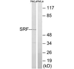 Western Blot - Anti-SRF Antibody (B8427) - Antibodies.com
