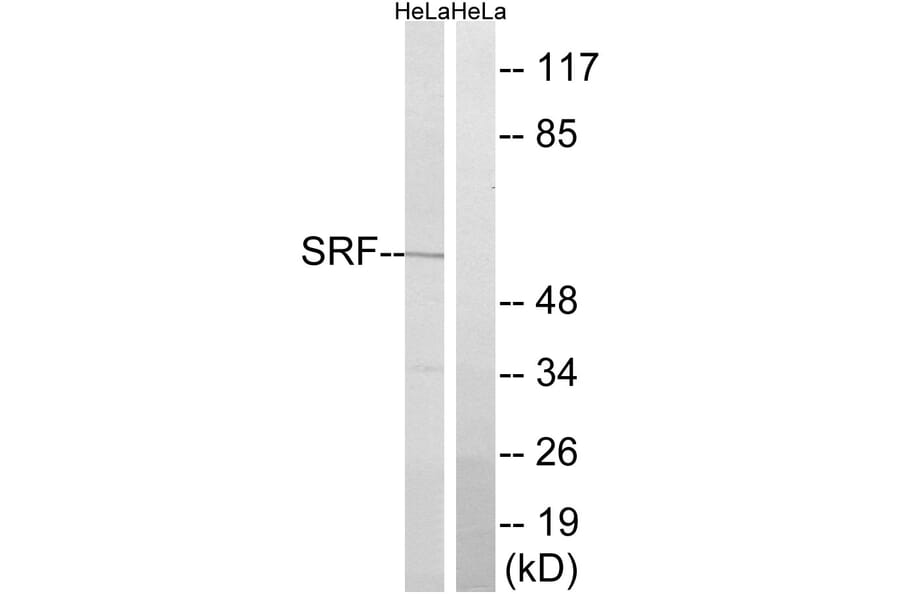 Western Blot - Anti-SRF Antibody (B8427) - Antibodies.com