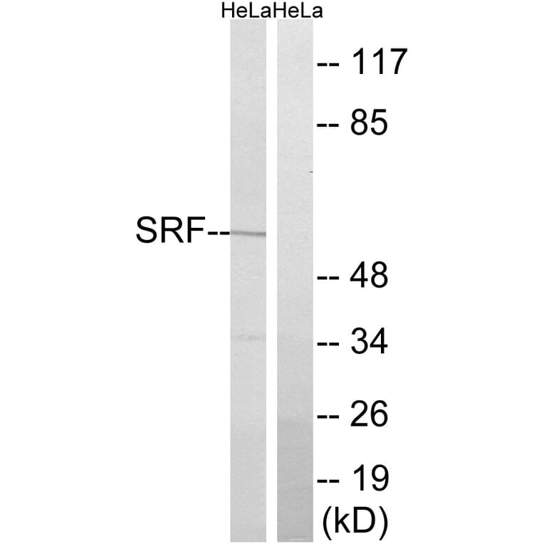 Western Blot - Anti-SRF Antibody (B8427) - Antibodies.com