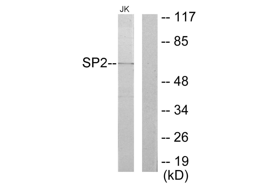 Western Blot - Anti-SP2 Antibody (C10844) - Antibodies.com