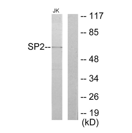 Western Blot - Anti-SP2 Antibody (C10844) - Antibodies.com