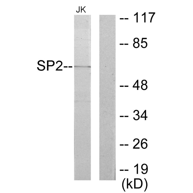 Western Blot - Anti-SP2 Antibody (C10844) - Antibodies.com