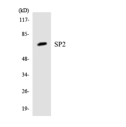 Western Blot - Anti-SP2 Antibody (R12-3552) - Antibodies.com