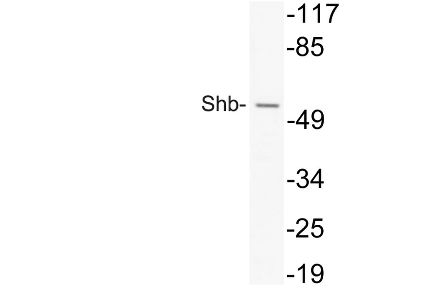 Western Blot - Anti-Shb Antibody (R12-2356) - Antibodies.com