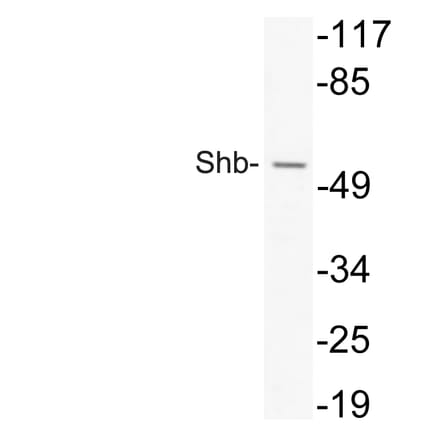 Western Blot - Anti-Shb Antibody (R12-2356) - Antibodies.com