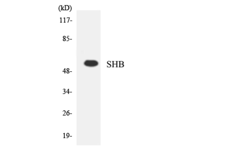 Western Blot - Anti-SHB Antibody (R12-3505) - Antibodies.com