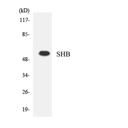 Western Blot - Anti-SHB Antibody (R12-3505) - Antibodies.com