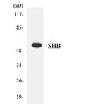 Western Blot - Anti-SHB Antibody (R12-3505) - Antibodies.com