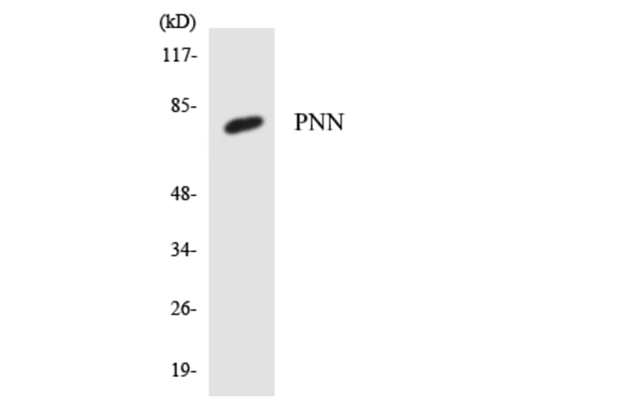 Western Blot - Anti-PNN Antibody (R12-3342) - Antibodies.com