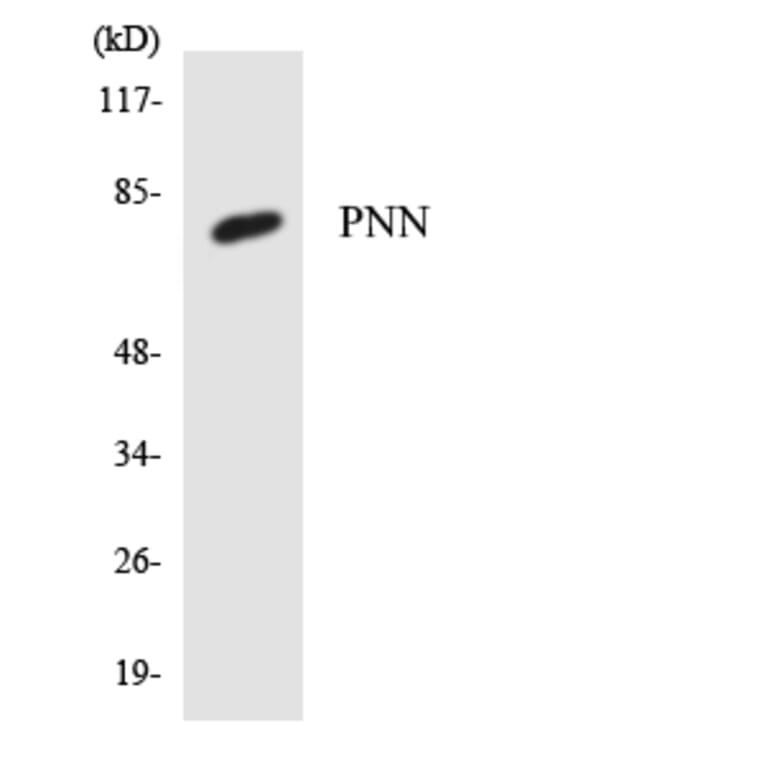Western Blot - Anti-PNN Antibody (R12-3342) - Antibodies.com