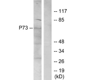 Western Blot - Anti-p73 Antibody (B7191) - Antibodies.com