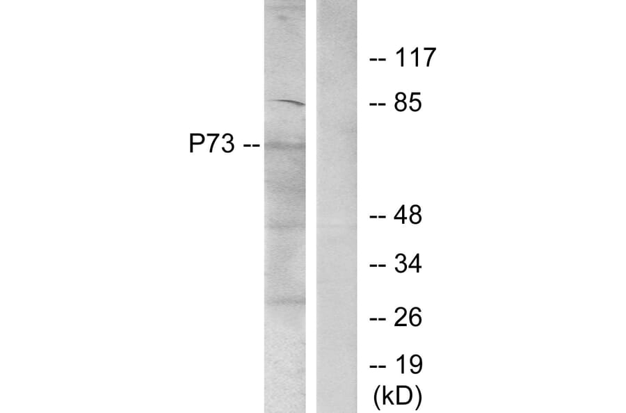 Western Blot - Anti-p73 Antibody (B7191) - Antibodies.com