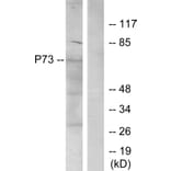 Western Blot - Anti-p73 Antibody (B7191) - Antibodies.com