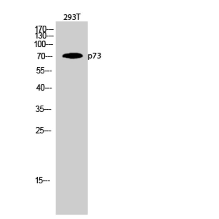 Western Blot - Anti-p73 Antibody (B7191) - Antibodies.com