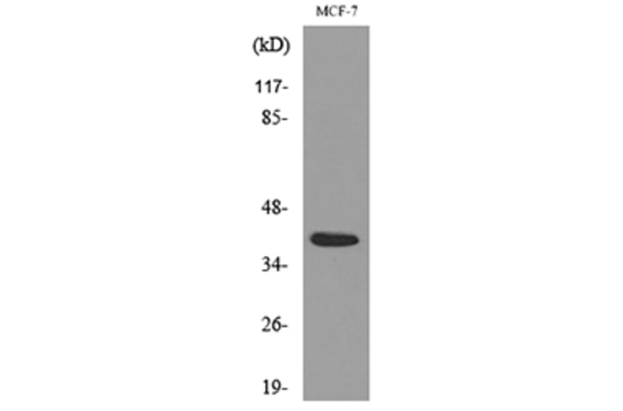 Western Blot - Anti-NOV Antibody (C30603) - Antibodies.com