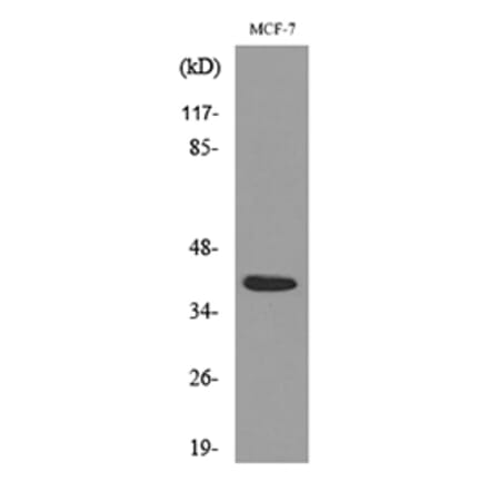 Western Blot - Anti-NOV Antibody (C30603) - Antibodies.com