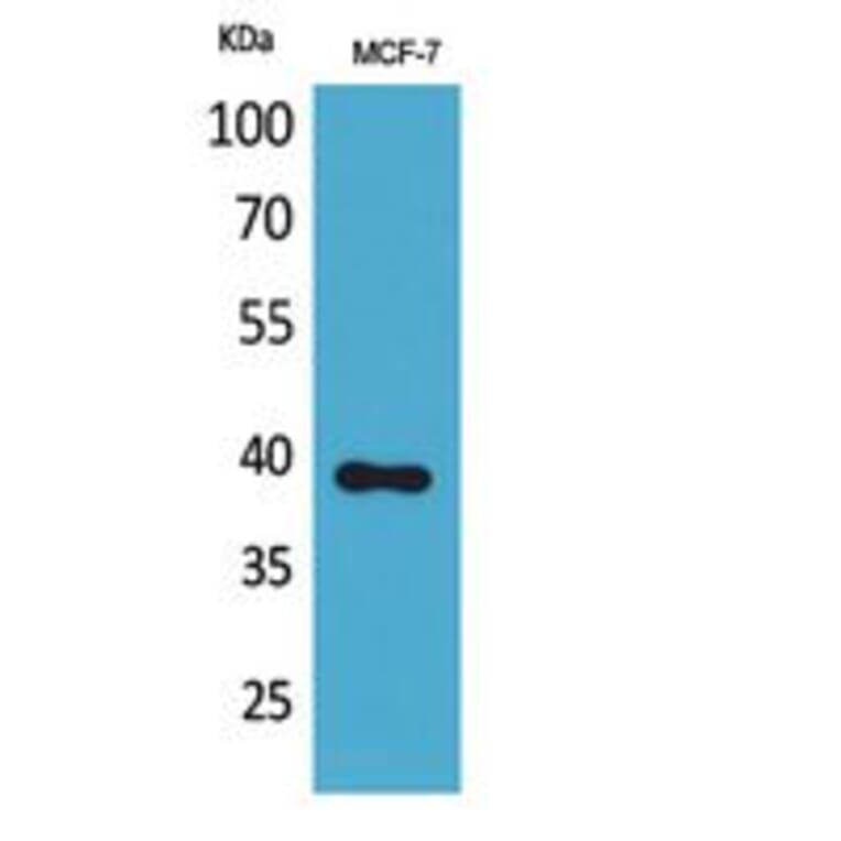 Western Blot - Anti-NOV Antibody (C30603) - Antibodies.com