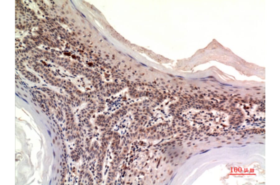 Immunohistochemistry - Anti-NOV Antibody (C30603) - Antibodies.com