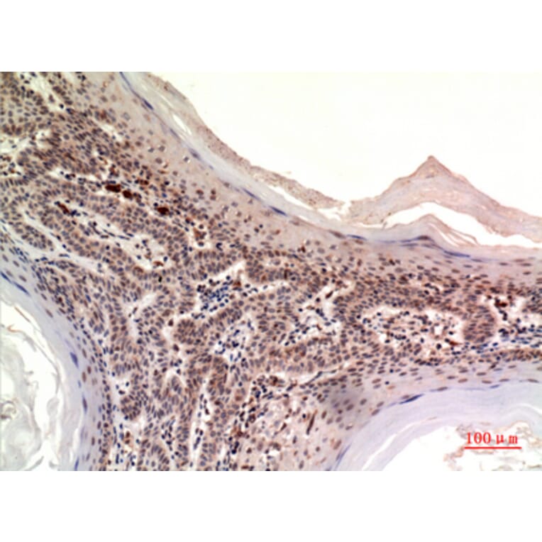Immunohistochemistry - Anti-NOV Antibody (C30603) - Antibodies.com