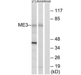 Western Blot - Anti-ME3 Antibody (C16864) - Antibodies.com