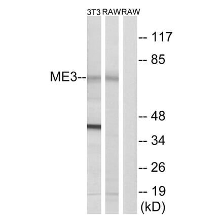 Western Blot - Anti-ME3 Antibody (C16864) - Antibodies.com