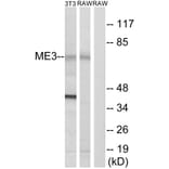 Western Blot - Anti-ME3 Antibody (C16864) - Antibodies.com