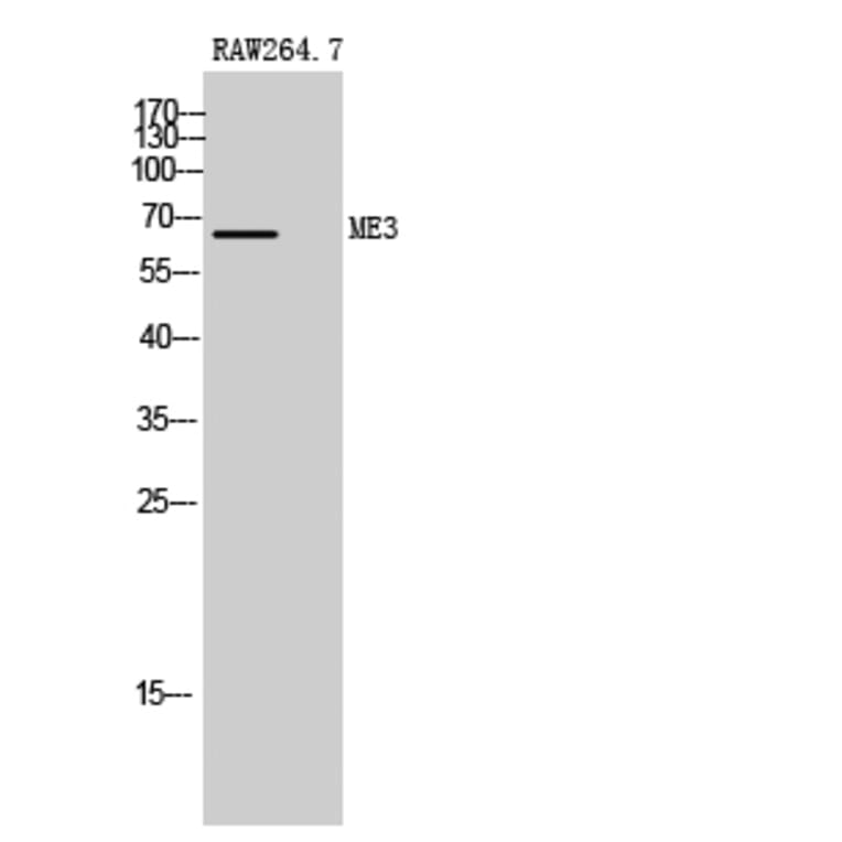 Western Blot - Anti-ME3 Antibody (C16864) - Antibodies.com