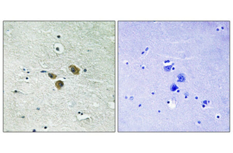 Immunohistochemistry - Anti-ME3 Antibody (C16864) - Antibodies.com