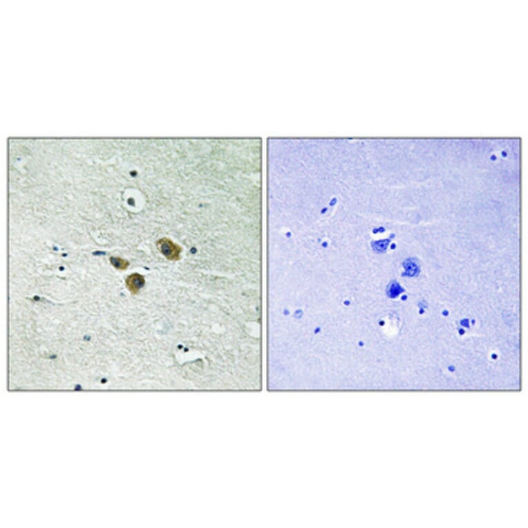 Immunohistochemistry - Anti-ME3 Antibody (C16864) - Antibodies.com