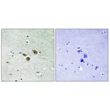 Immunohistochemistry - Anti-ME3 Antibody (C16864) - Antibodies.com