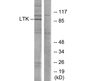 Western Blot - Anti-LTK Antibody (C10512) - Antibodies.com